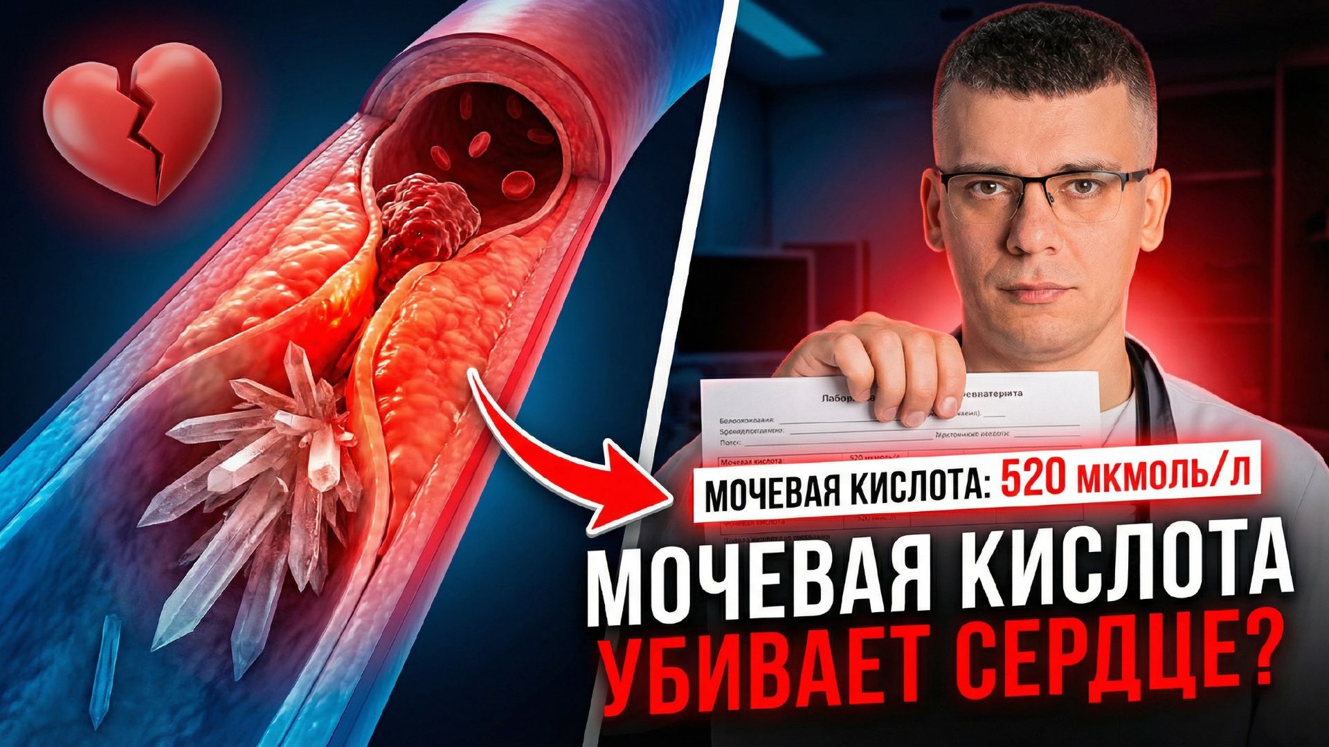 Мочевая кислота ВЫШЕ НОРМЫ_ как снизить быстро и без вреда для почек.