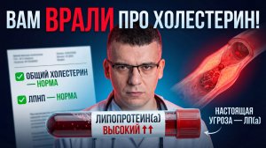 Вам ВРАЛИ про Холестерин! Скрытая и главная причина ИНФАРКТА