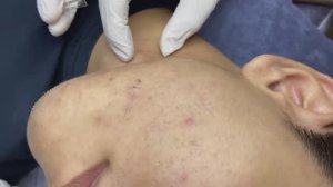 027 • Relax Spa • АСМР • Acne collection