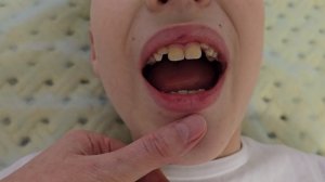 Постановка шипящих [Ш], [Ж]: когда логопедия начинается не со звуков. Лого-фасциальный метод.