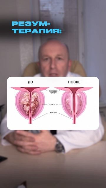 ЧЕМ ЛЕЧИТЬ АДЕНОМУ?