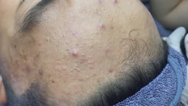 029 • Relax Spa • АСМР • Acne collection