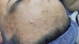 029 • Relax Spa • АСМР • Acne collection