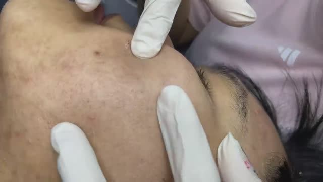 028 • Relax Spa • АСМР • Acne collection