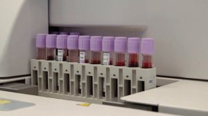 Рубрика «Будьте здоровы» - врач клинико-диагностической лаборатории Наталья Вячеславовна Лакстигаль