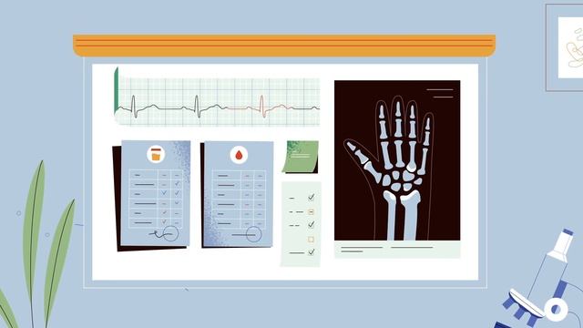 Лечение ревматоидного артрита