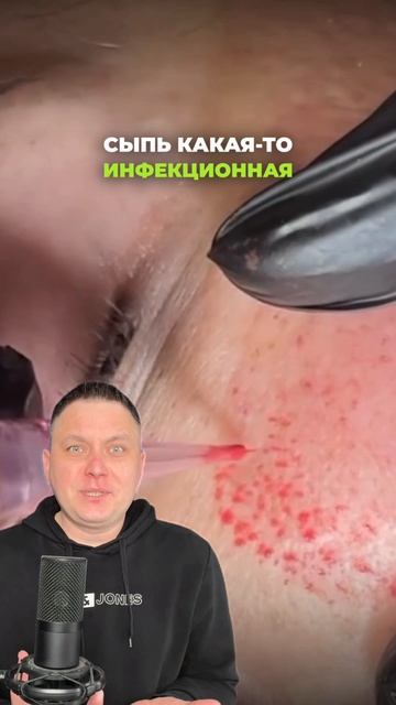 Блог про удаление ПМ и тату!  Подписывайся! #лазерноеудалениятату #перманентныймакияж #татуаж