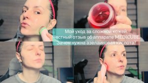 Моя рутина в уходе. Кому нужна азелаиновая кислота? Честный отзыв об аппарате Medicube.