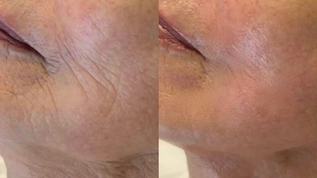 -7359570421800955859