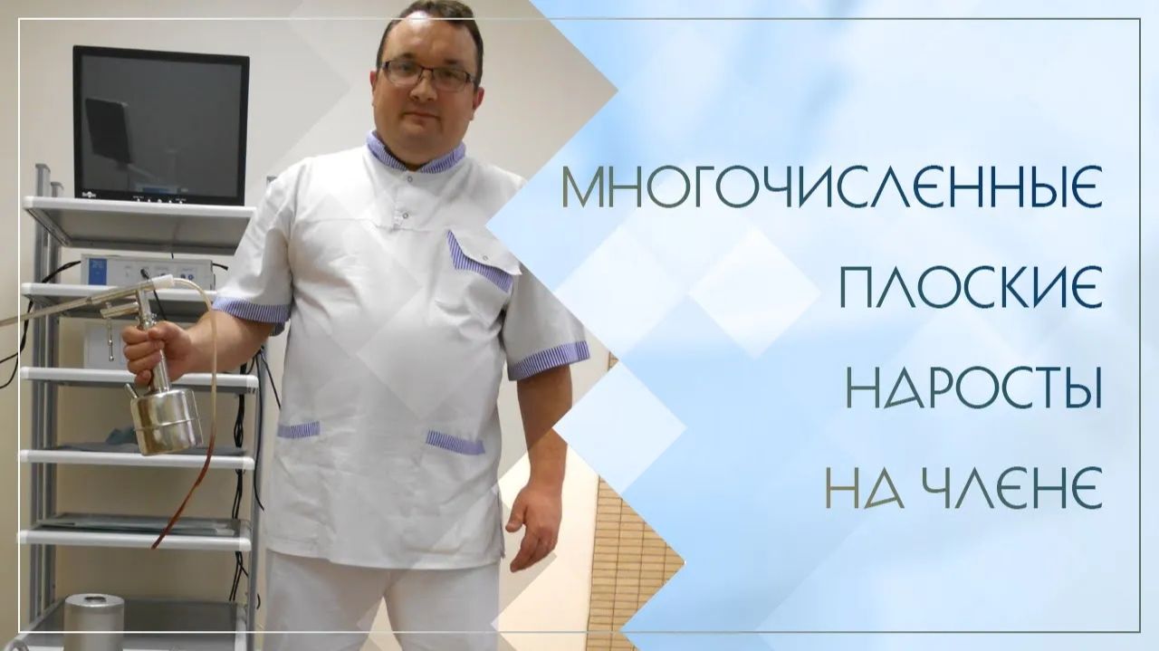 😲 Многочисленные плоские наросты на члене. Клинический случай №95 смотреть онлайн