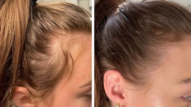 -5031156523375613551