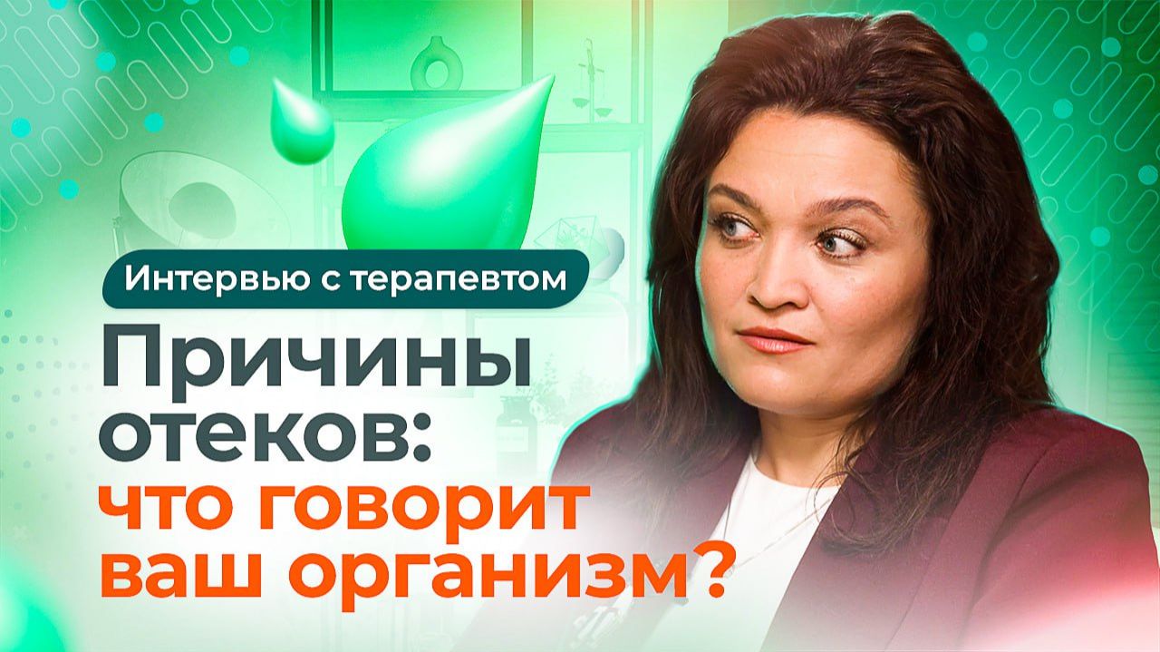 Как убрать отёки? Рекомендации терапевта