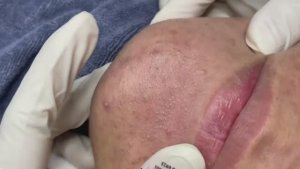 032 • Relax Spa • АСМР • Acne collection