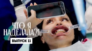 Что я наделала?! Перевернутый имплант