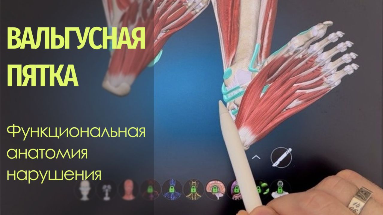 Вальгус. Вальгусная пятка. Функциональная анатомия нарушения
