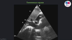eFAST протокол Щепарев И.С.