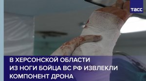 В Херсонской области из ноги бойца ВС РФ извлекли компонент дрона