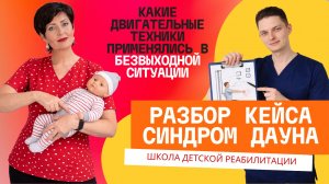 Разбор кейса ребёнка с синдромом Дауна