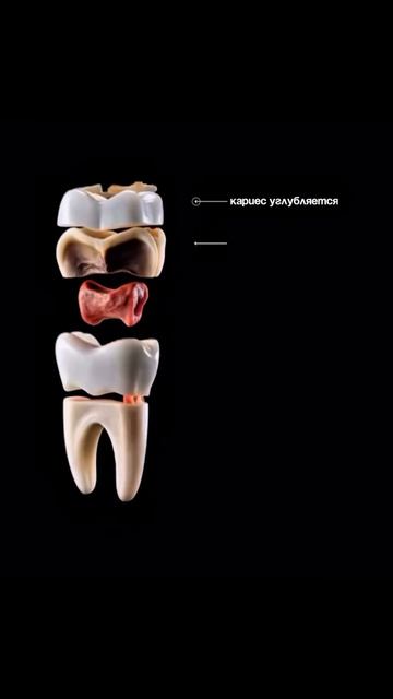 Что происходит, когда вы терпите зубную боль 👇🏻