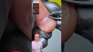 Налипшая кутикула, сильные заусенцы, трещины на ногтевой пластине и она  признает, что  ковыряет 😔