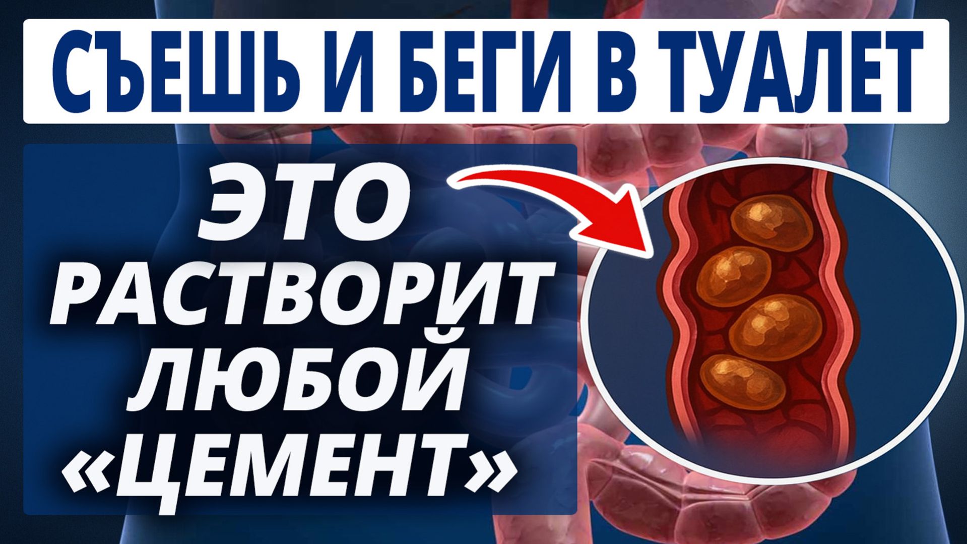 Как БЫСТРО Избавиться от ЗАПОРА? 5 ШАГОВ, которые улучшат работу КИШЕЧНИКА