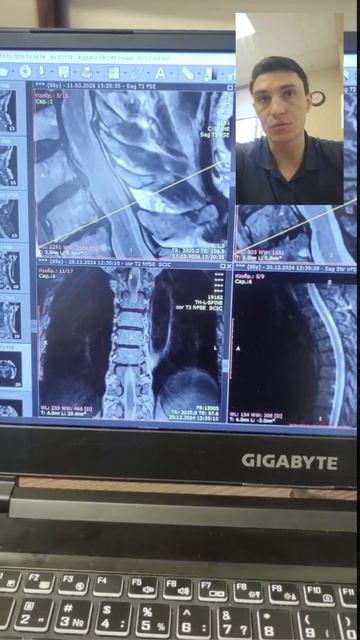 Боль в спине: 1 причина, почему упражнения делают хуже