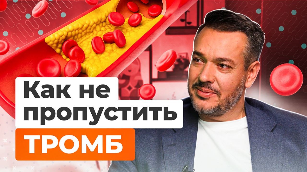 ТРОМБ ОТОРВАЛСЯ: тромбоз вен нижних конечностей, как избежать, каковы симптомы тромбоза?