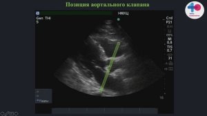 HOW TO волемич статус легочная артерия