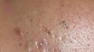 Удаление черных и белых точек — ПОЛНОЕ РУКОВОДСТВО