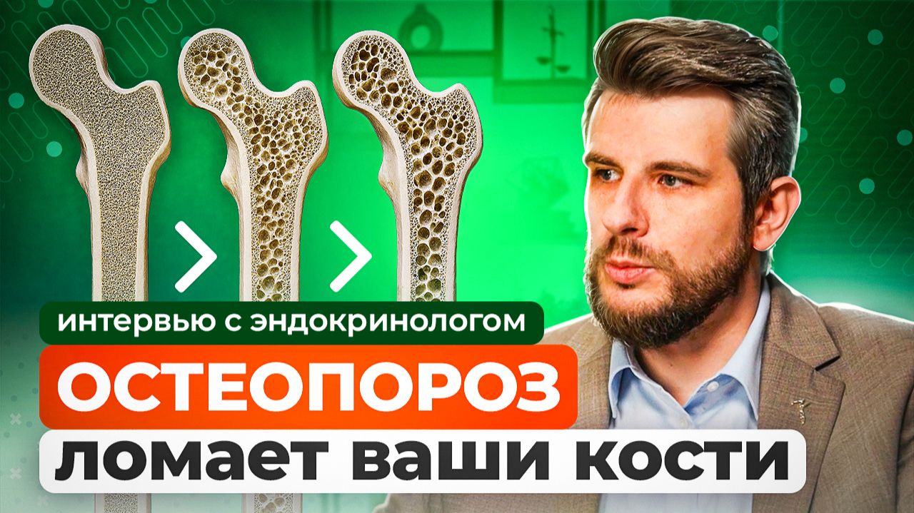 ОСТЕОПОРОЗ: как избежать переломов после 50?  Скрытые симптомы заболевания