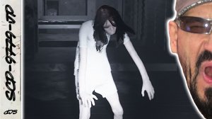 Кривоногая тянка охотиться за мной SCP-9779-JP