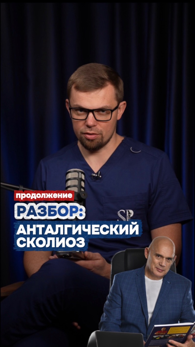 Анталгический сколиоз 2 часть