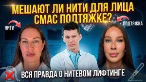 Как НИТИ могут испортить результат СМАС подтяжки? Нити для лица и SMAS-лифтинг