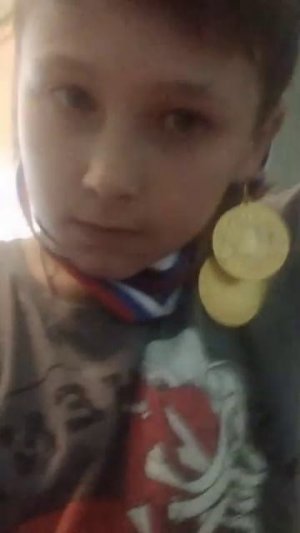 обзор на медали