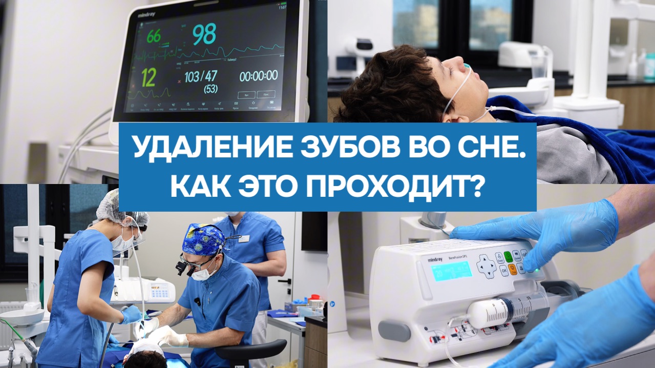 Удаление зубов мудрости во сне: как проходит седация на самом деле