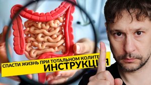 ТОТАЛЬНЫЙ ЯЗВЕННЫЙ КОЛИТ: От Симптомов К Выздоровлению
