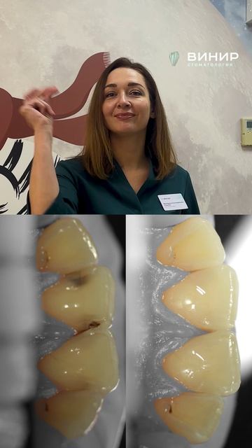 Дентальный микроскоп — спасает зубы