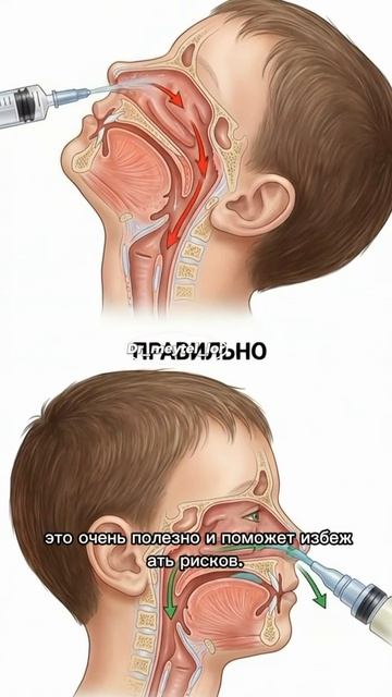 КАК ПРОМЫВАТЬ НОС? Рассказываю в своем блоге ПОДПИШИСЬ