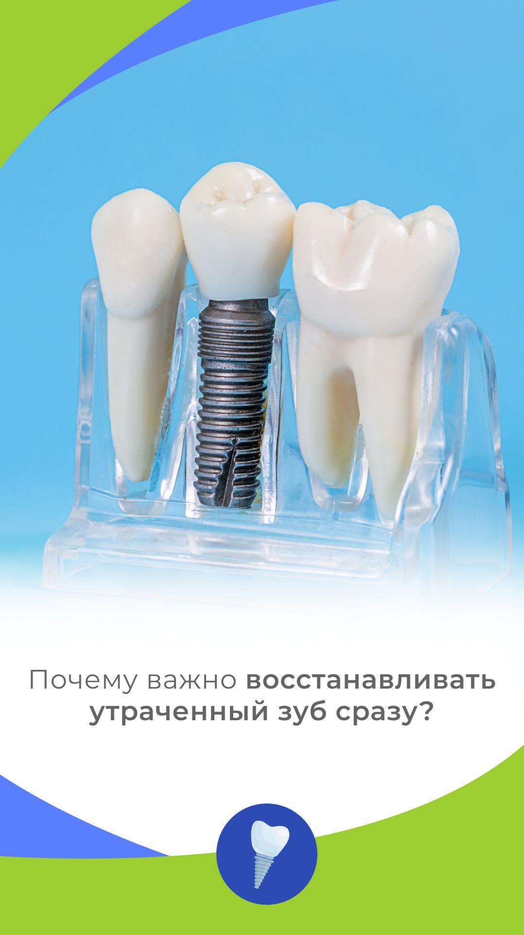 Почему важно восстанавливать утраченный зуб сразу