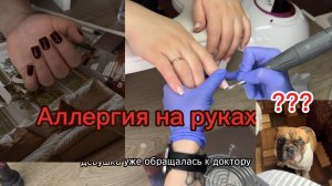 Коррекция, аллергия на руках😱