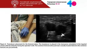 УЗИ при СЛР  1 Щепарев И.С.