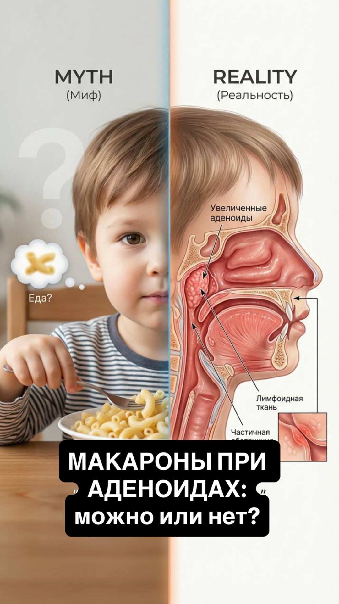 Про отиты в моем бесплатном проекте Ссылка в описании канала ПОДПИШИСЬ #лор #аденоиды #здоровье
