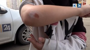 Сбитая питбайкером в Краснодаре девочка рассказала подробности аварии