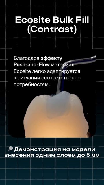 Ecosite Bulk Fill (Contrast) 🆕