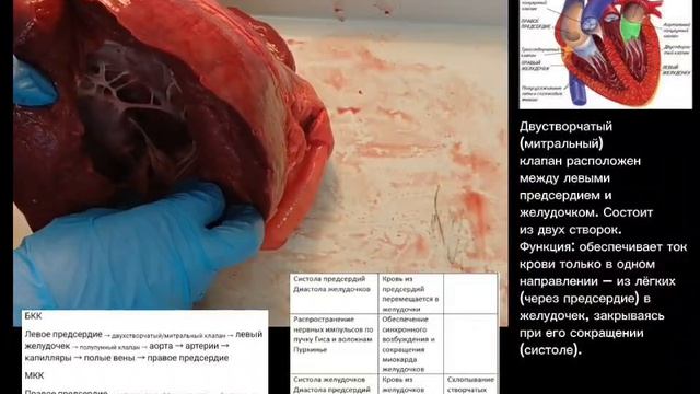 Препарирование сердца