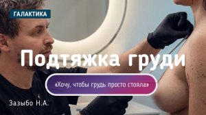 Подтяжка груди с имплантами без якорного рубца | Дарья у Николая Зазыбо