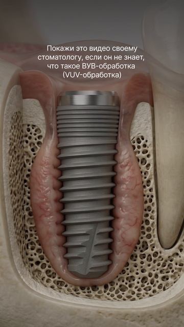 Что такое ВУВ-обработка VUV-обработка и почему о ней сейчас так много говорят? 