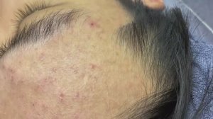 039 • Relax Spa • АСМР • Acne collection