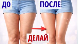 Как ИЗБАВИТЬСЯ от ЦЕЛЛЮЛИТА и дряблости за 10 минут в день?