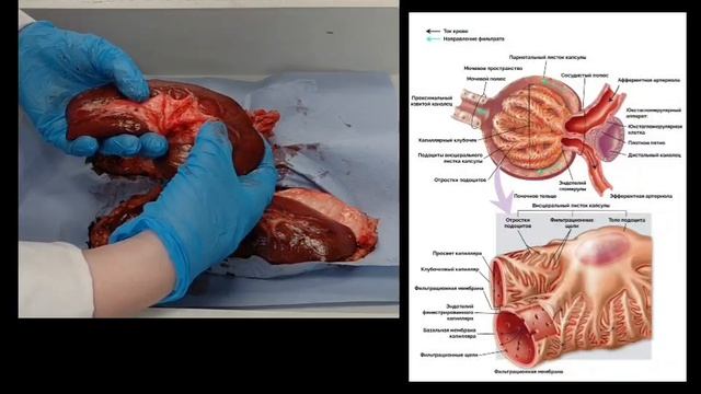 Препарирование почки